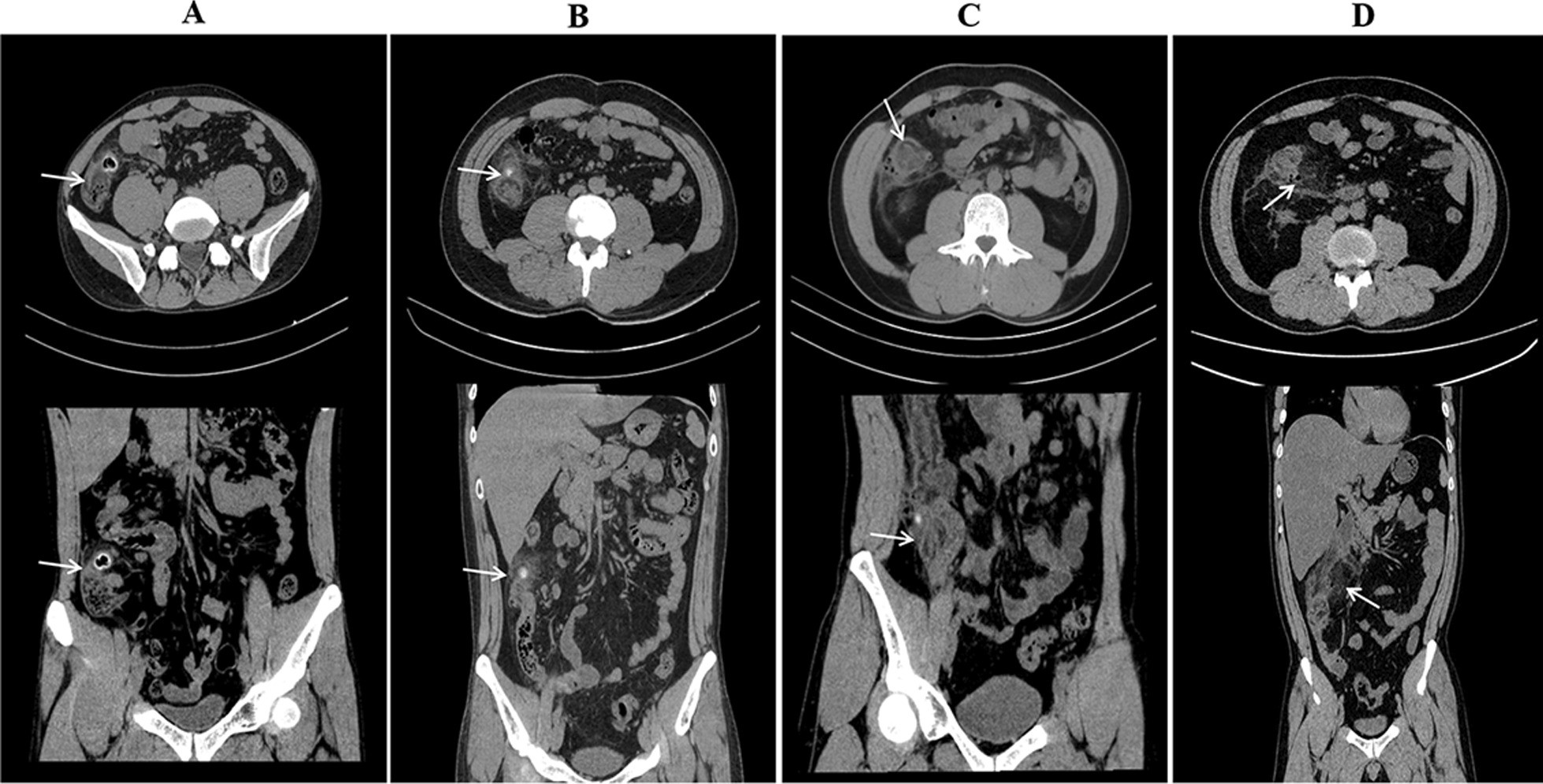 Fig. 1