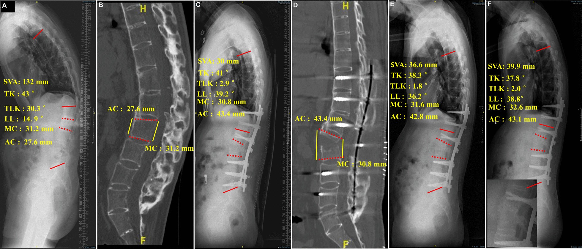 Fig. 4