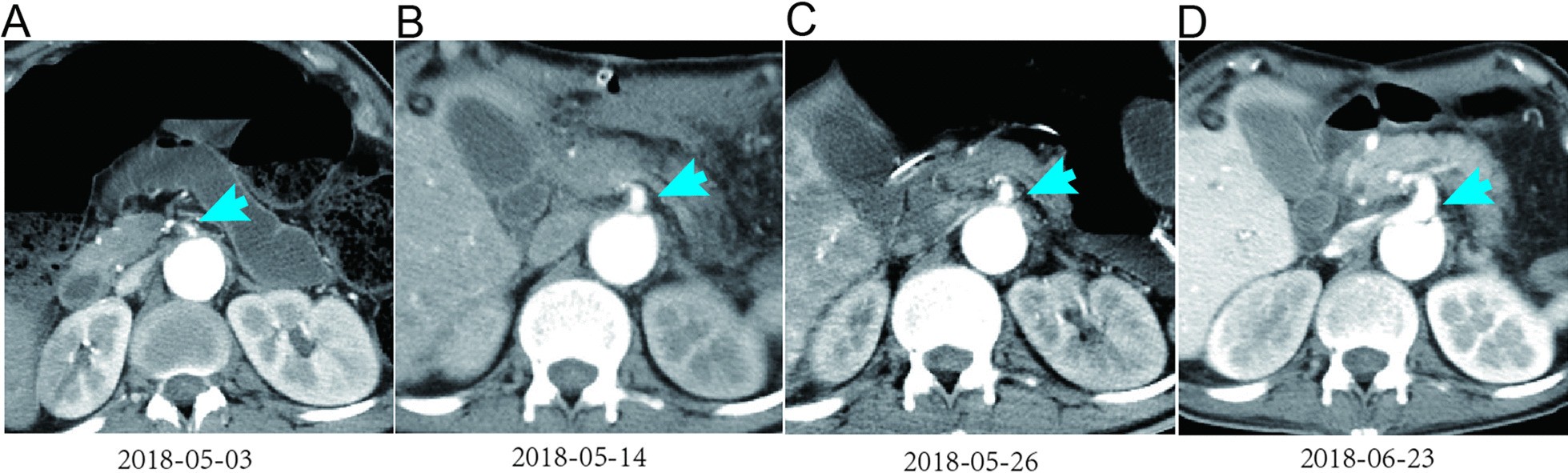 Fig. 4