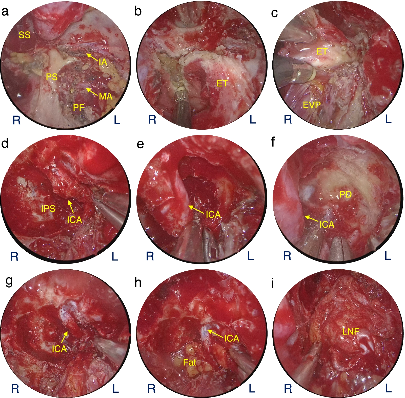 Fig. 4