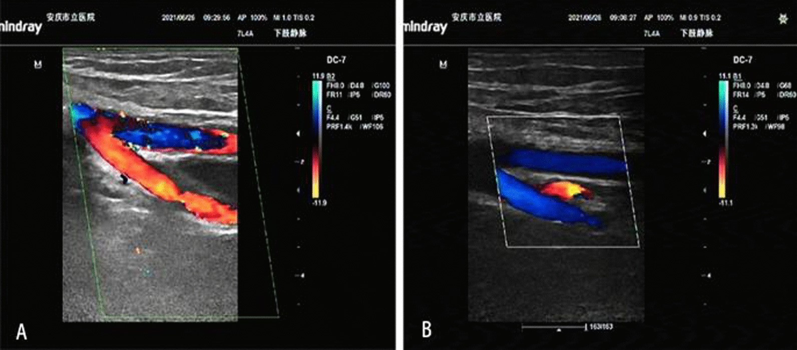 Fig. 6