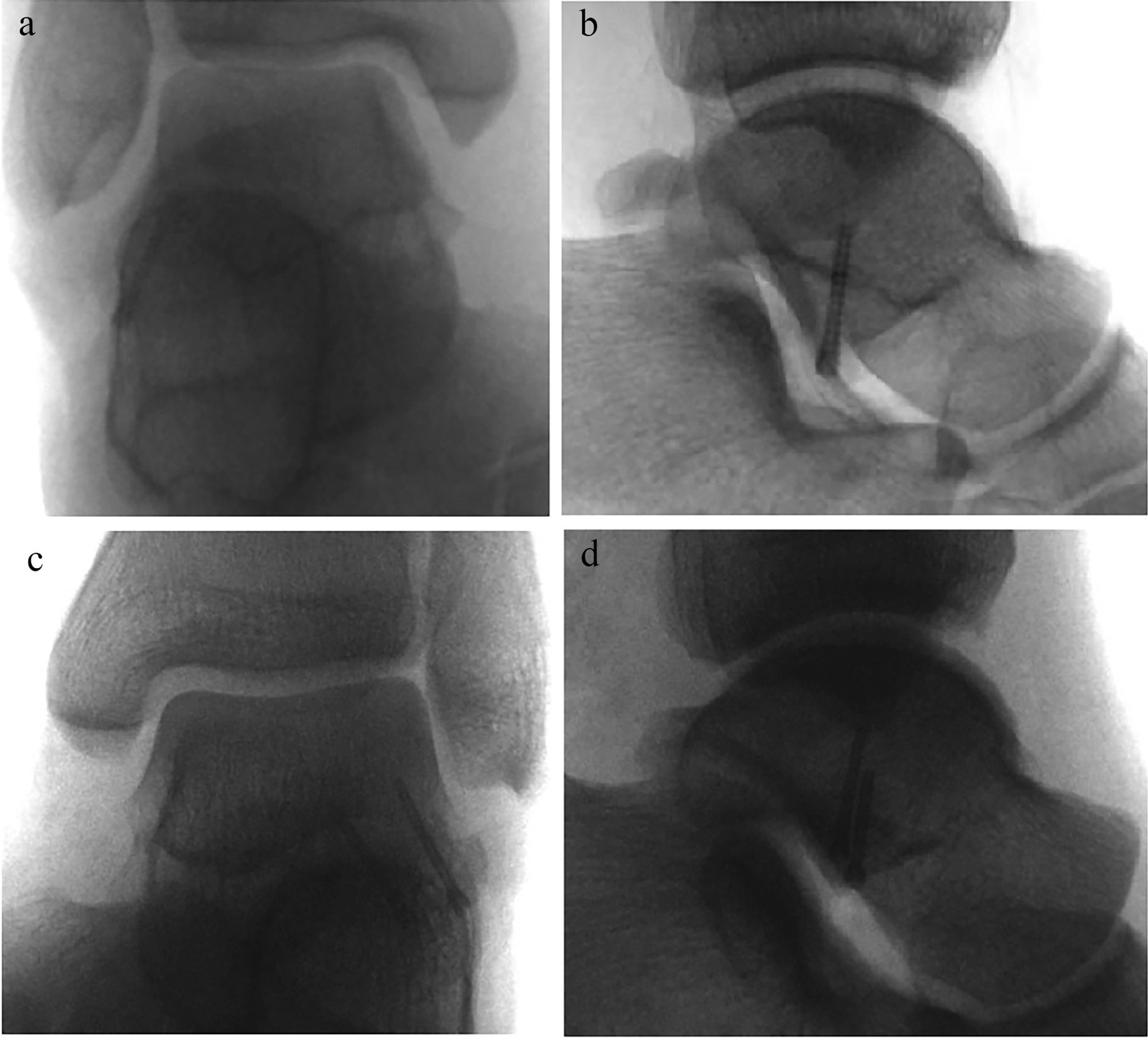 Fig. 3