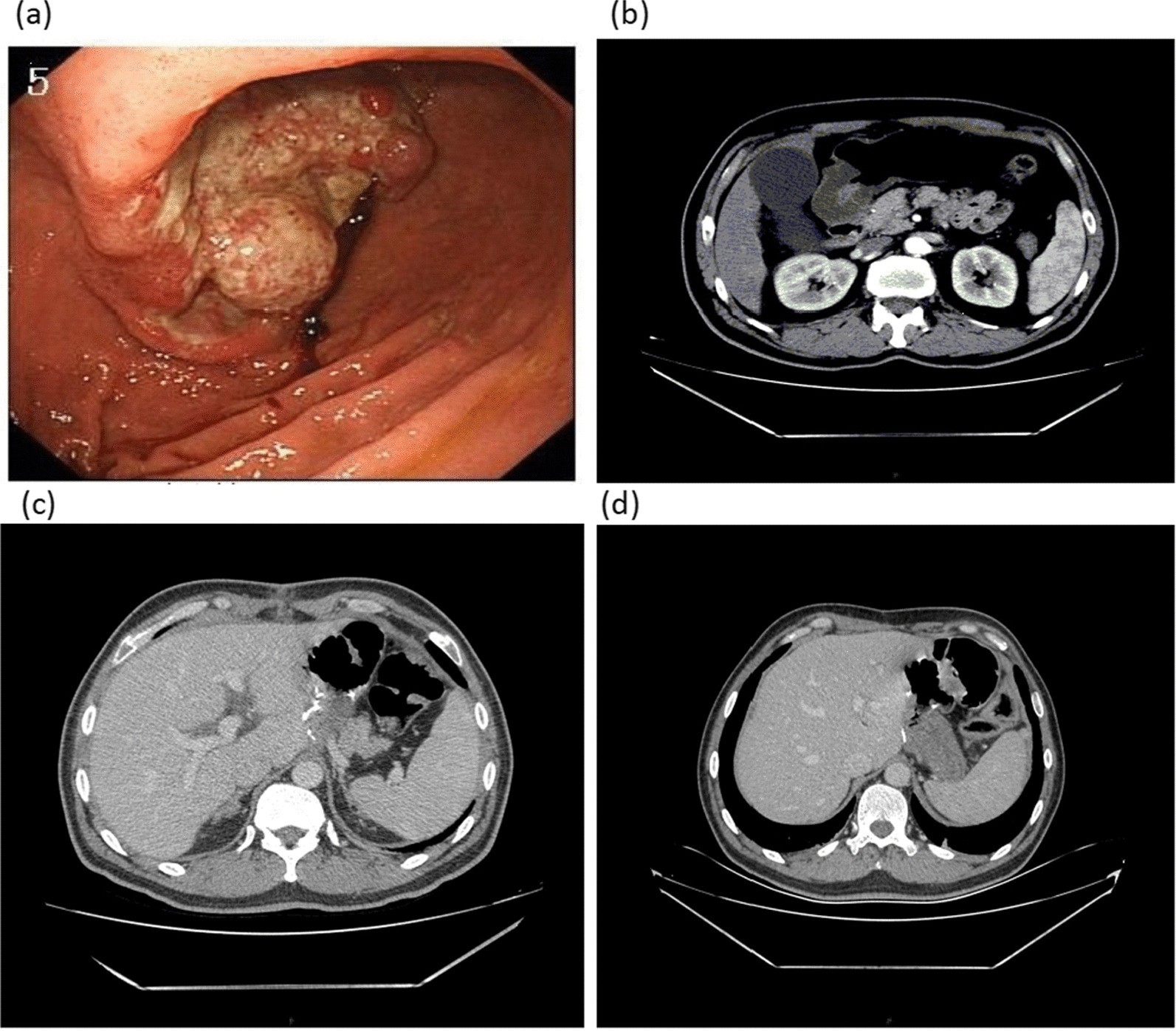 Fig. 4