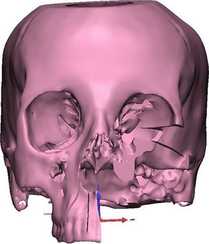 Fig. 2