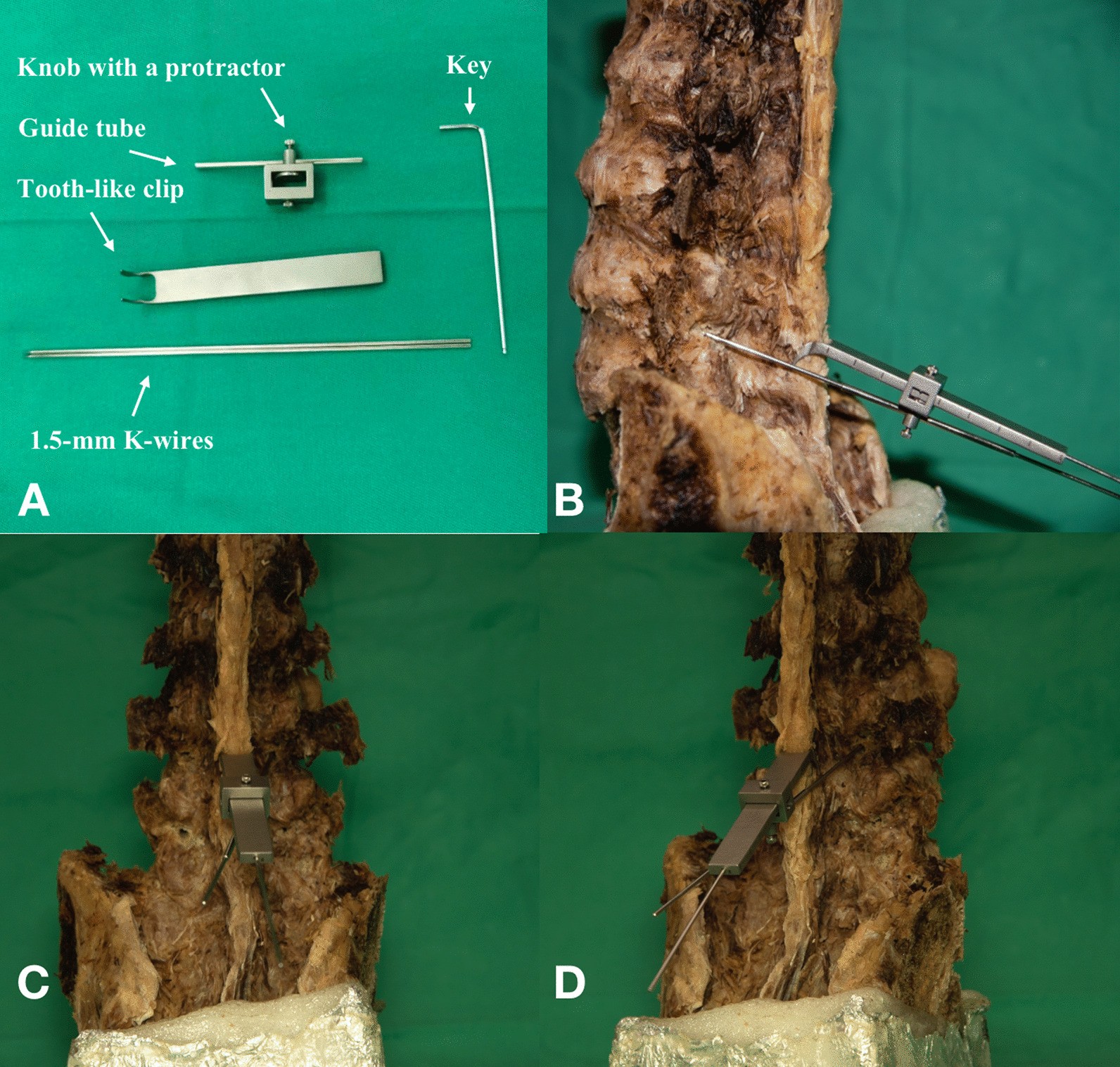 Fig. 2