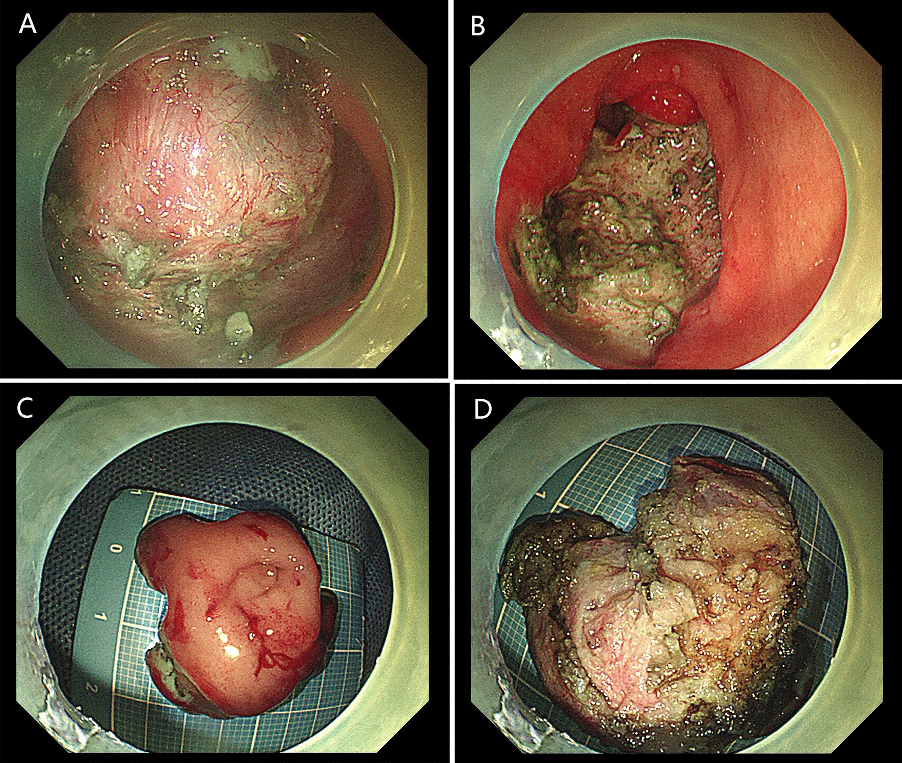 Fig. 4