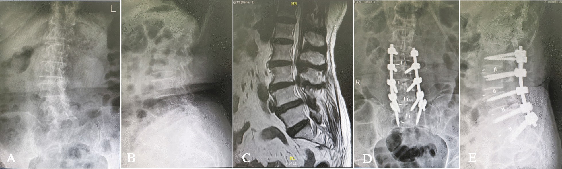 Fig. 2