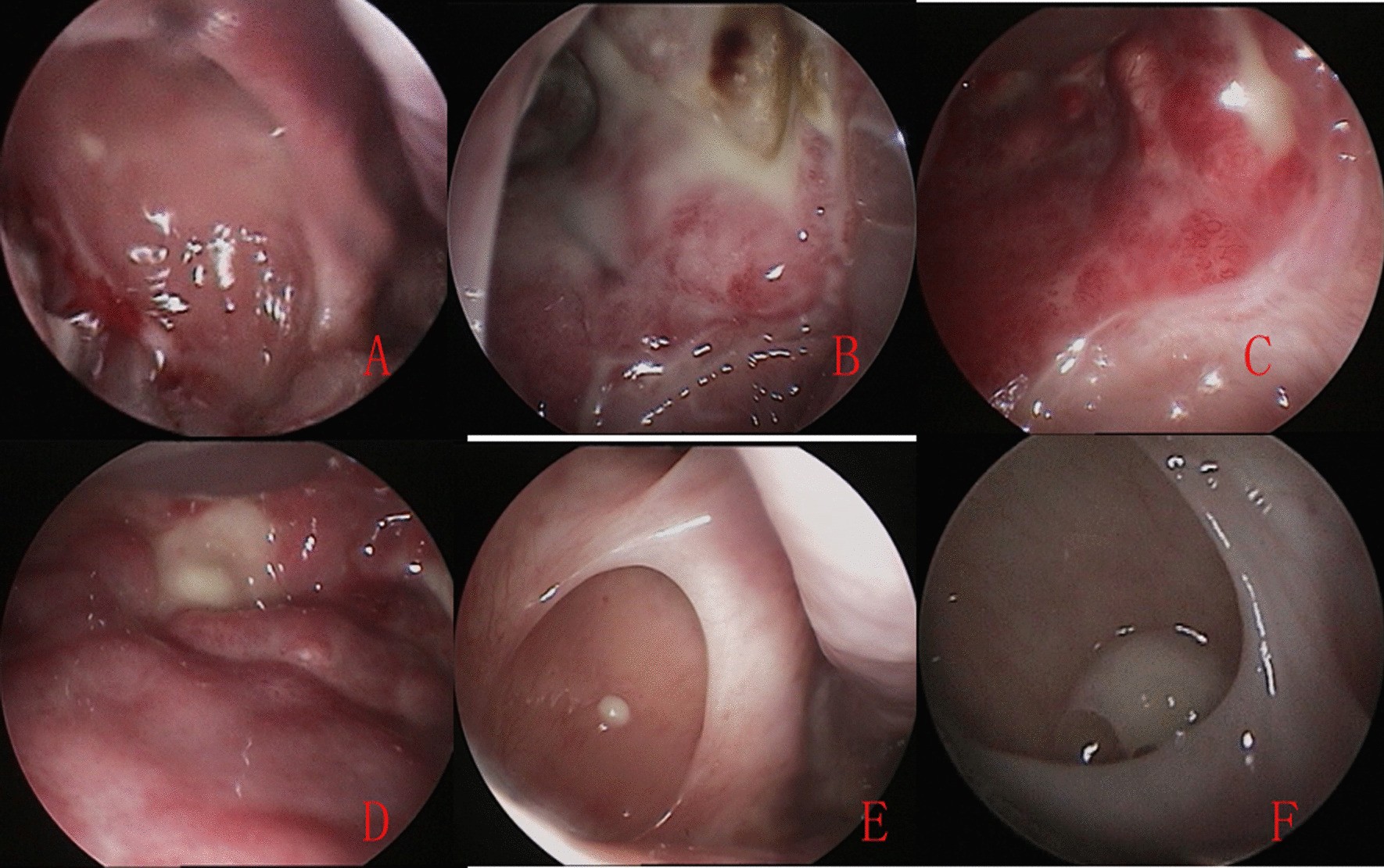 Fig. 4