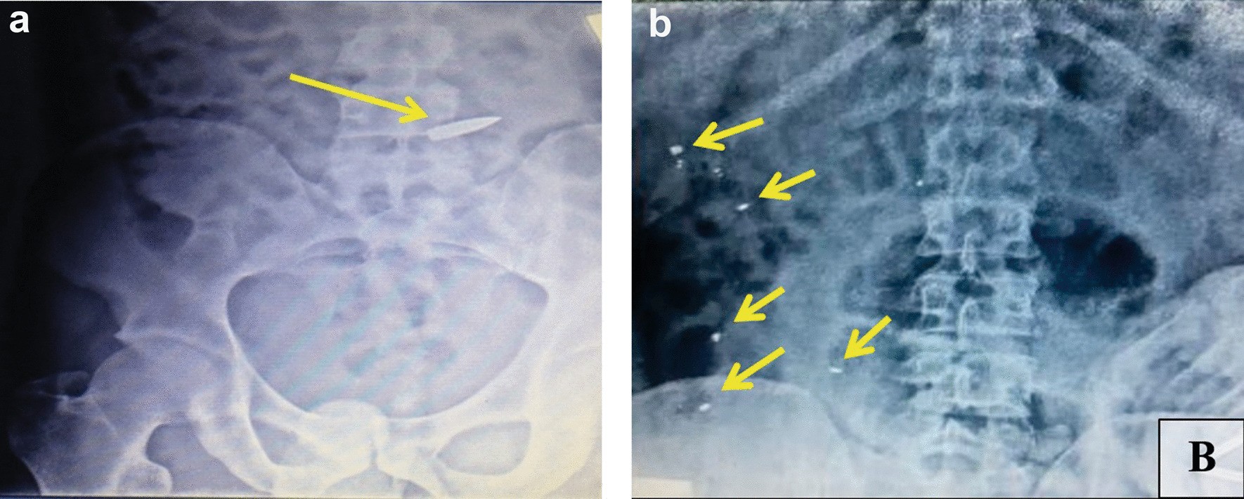 Fig. 3