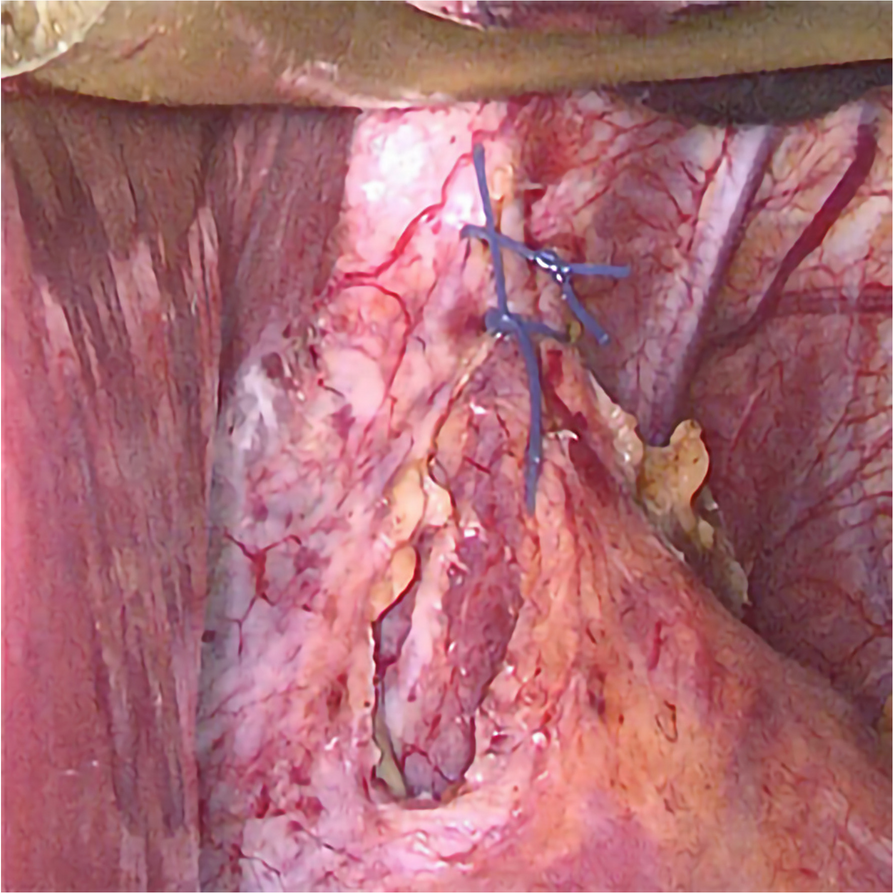 Fig. 3