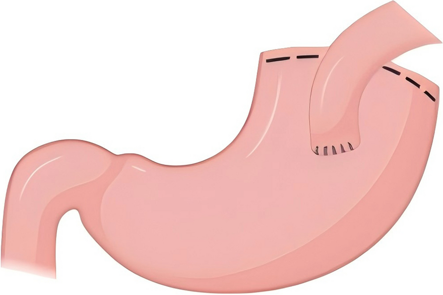 Fig. 2