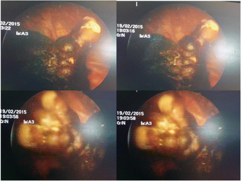 Fig. 2