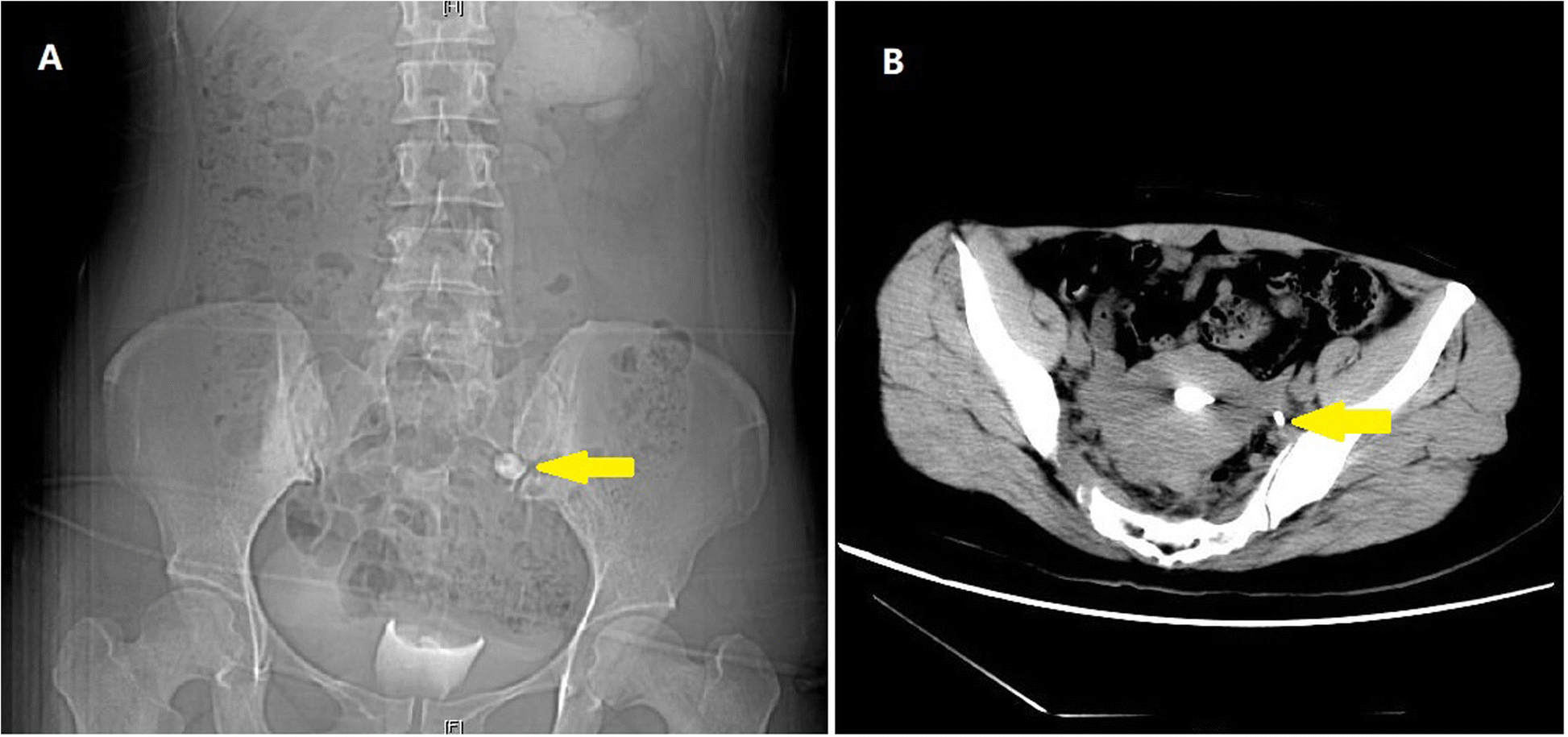 Fig. 2