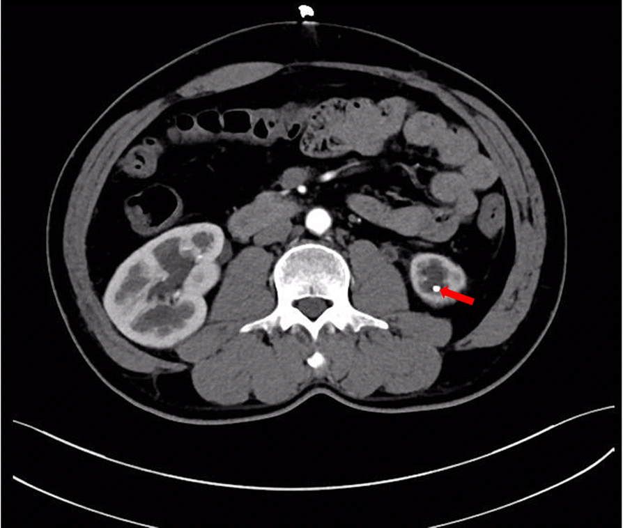 Fig. 2