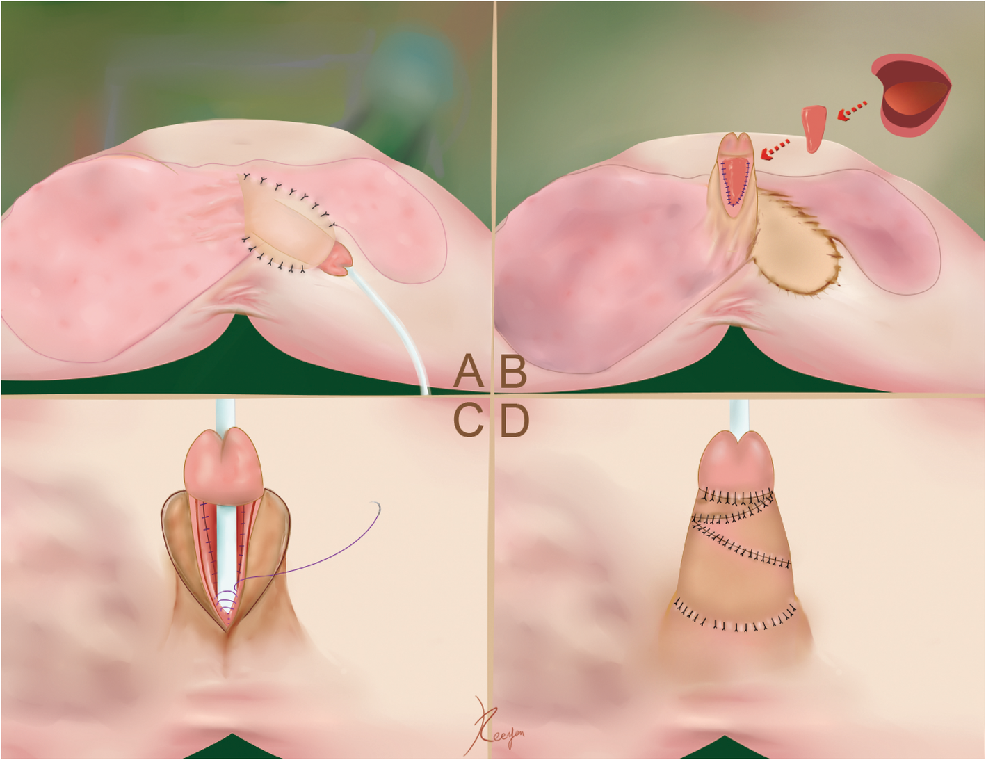 Fig. 1