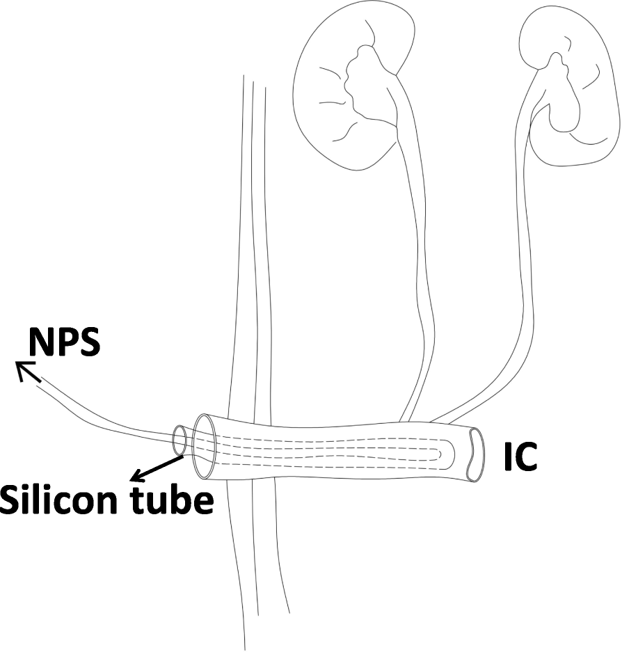 Sketch map of the urinary bladder. | Download Scientific Diagram