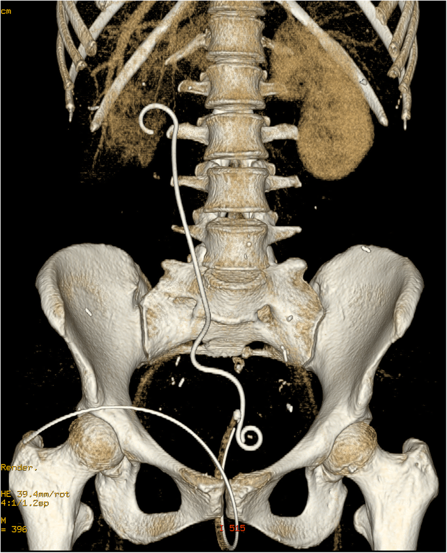 Fig. 1