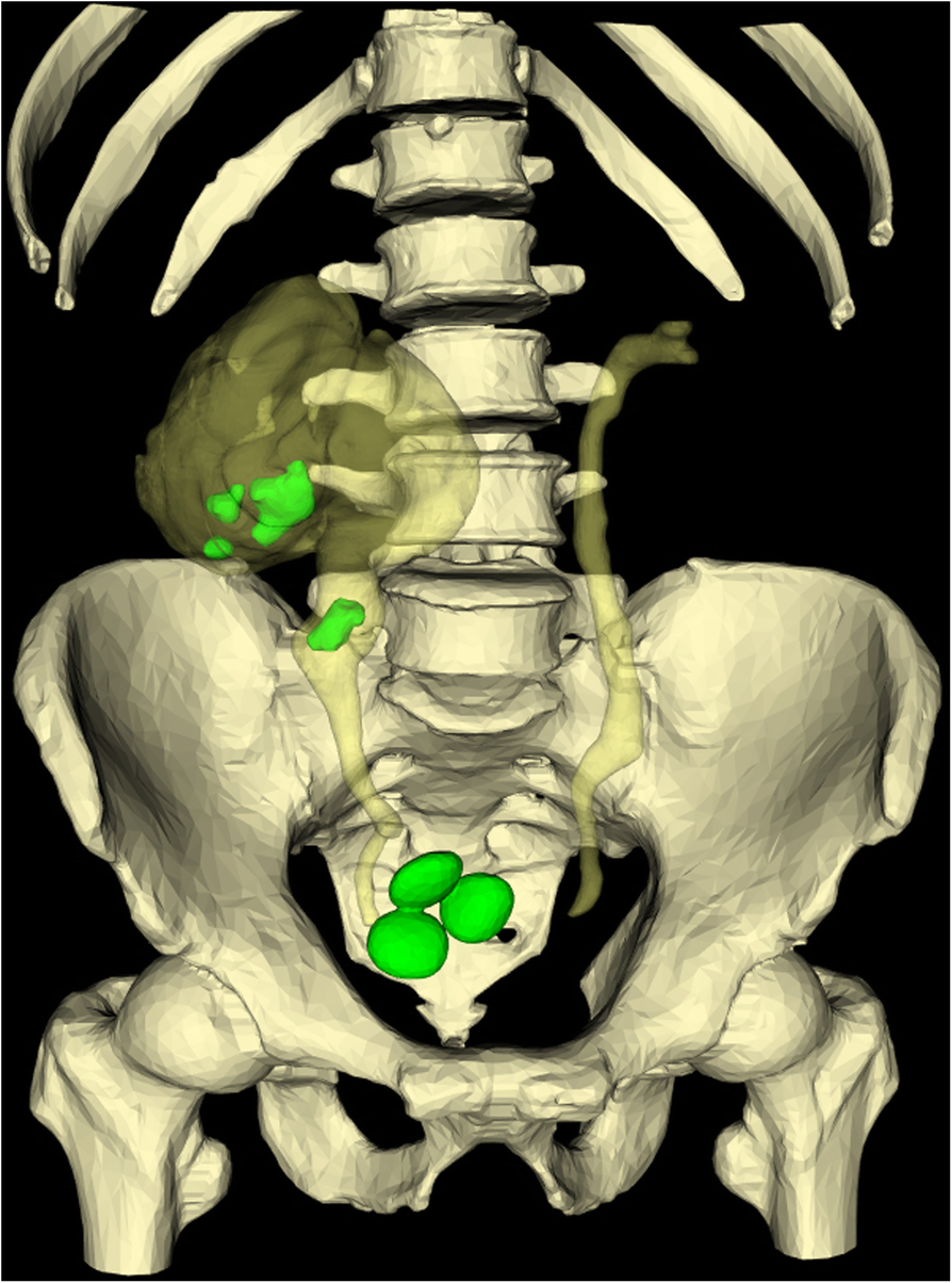 Fig. 2