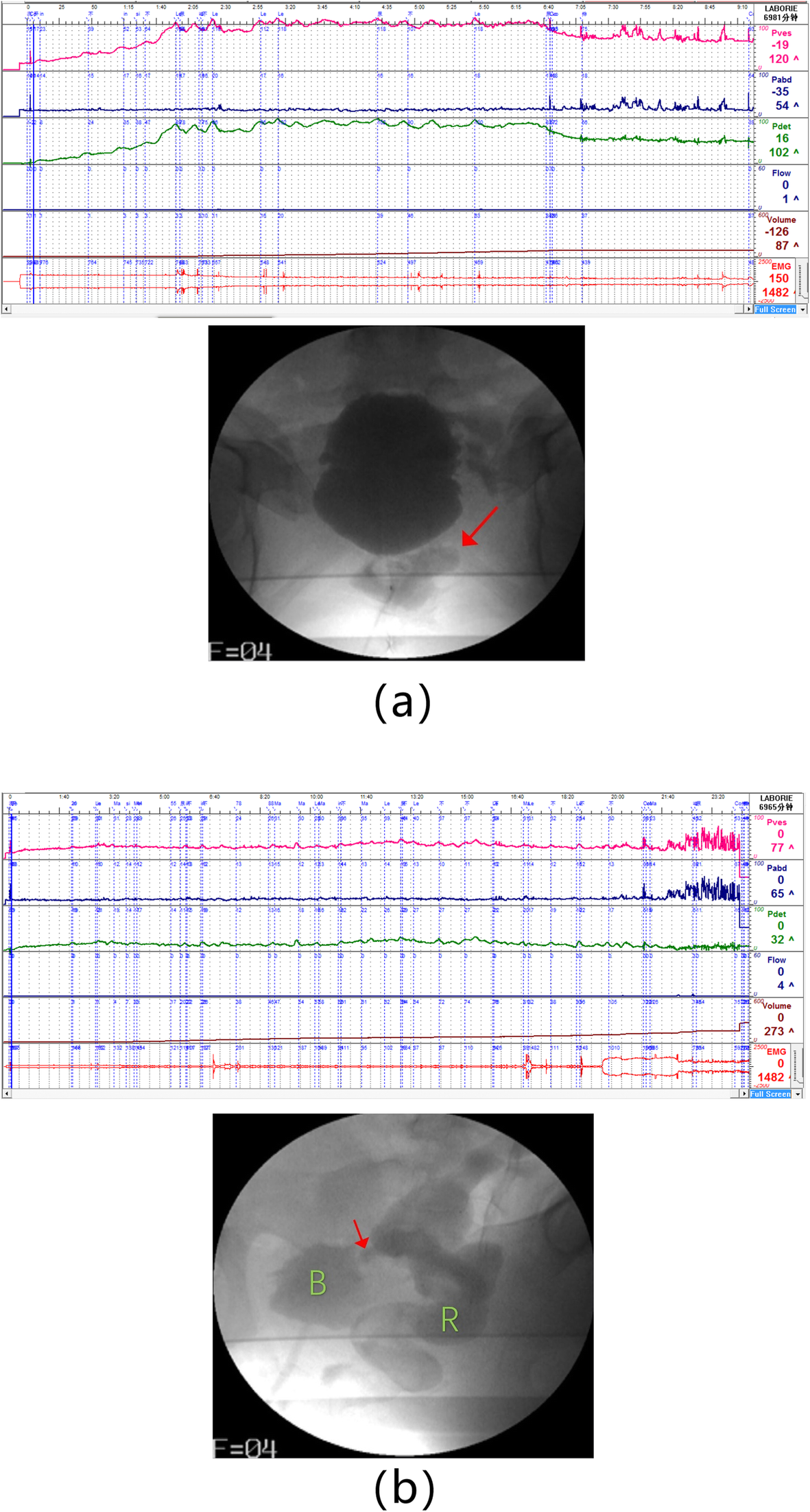 Fig. 1