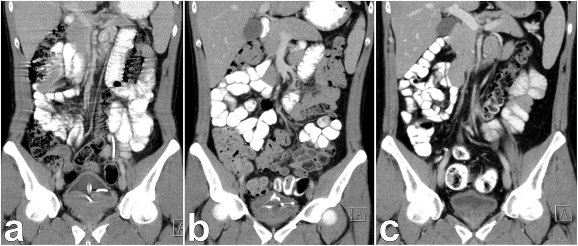 Fig. 4