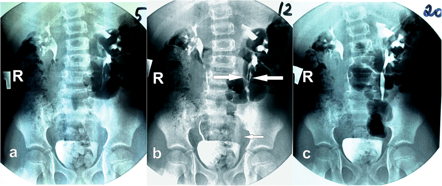 Fig. 4