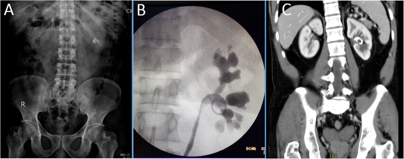 Fig. 1