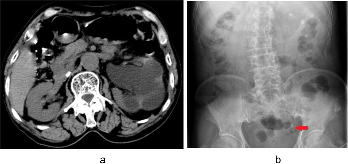 Fig. 1