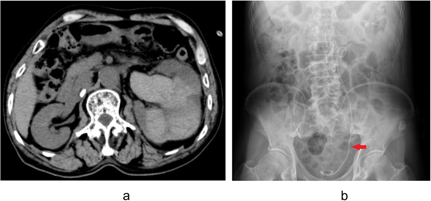 Fig. 2