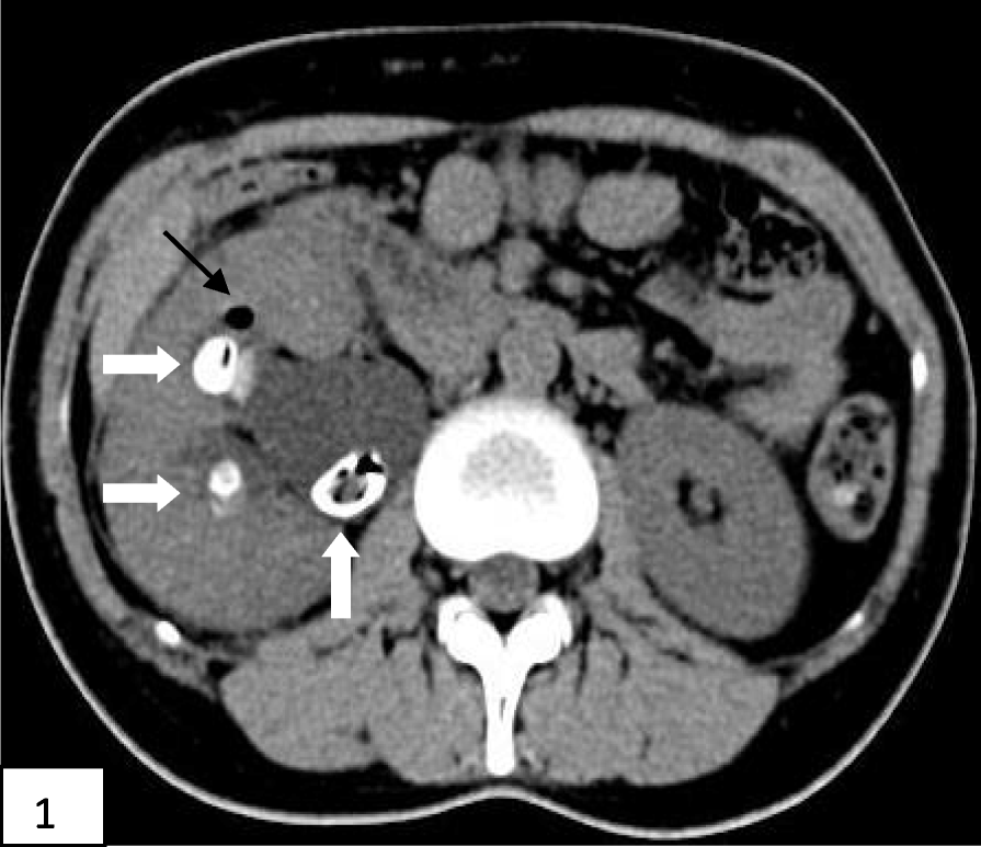 Fig. 1