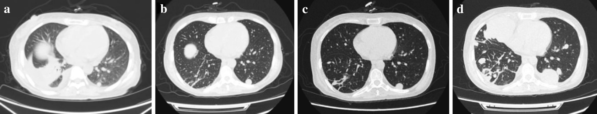 Fig.2