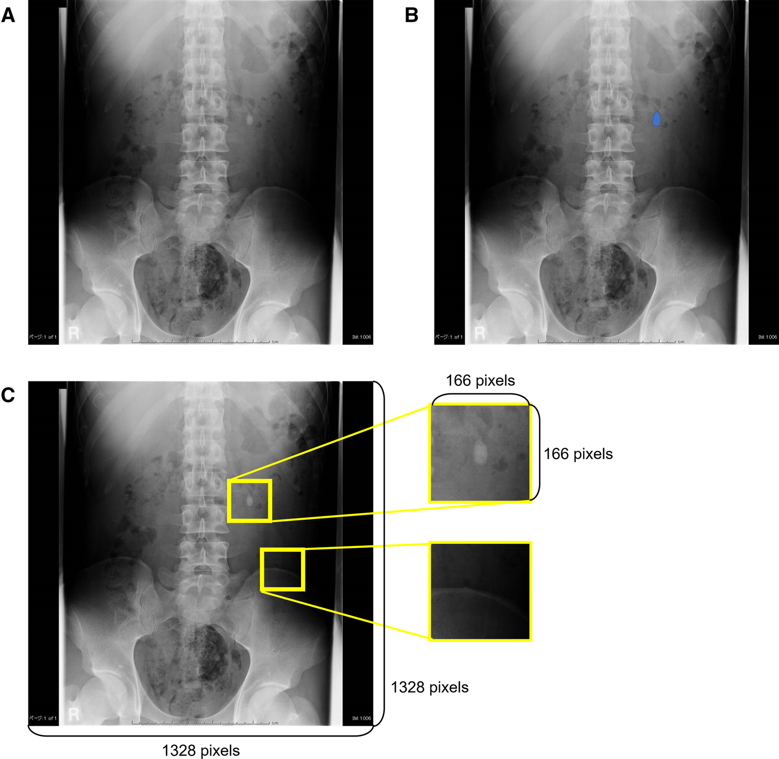 Fig. 2