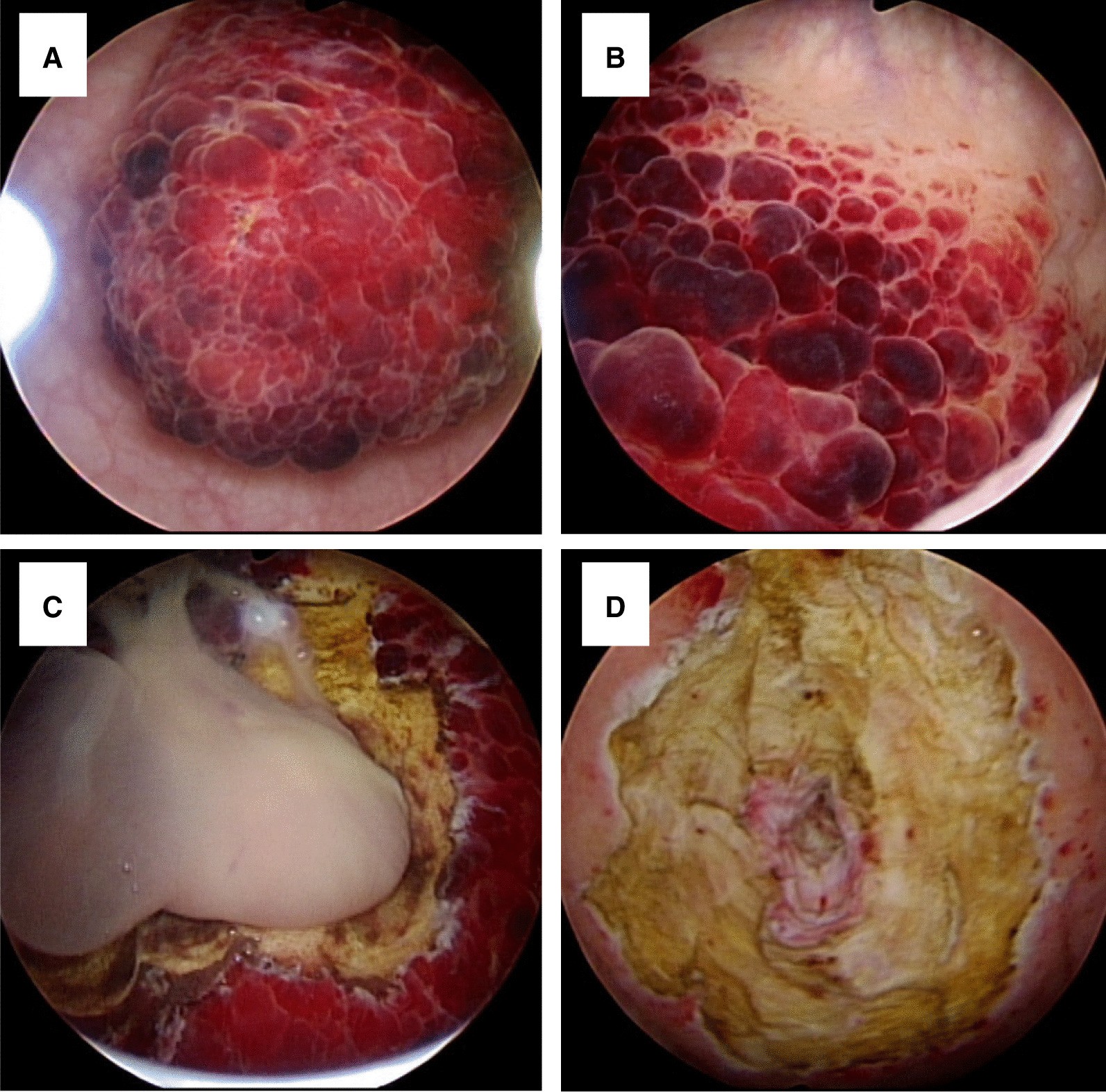 Fig. 2