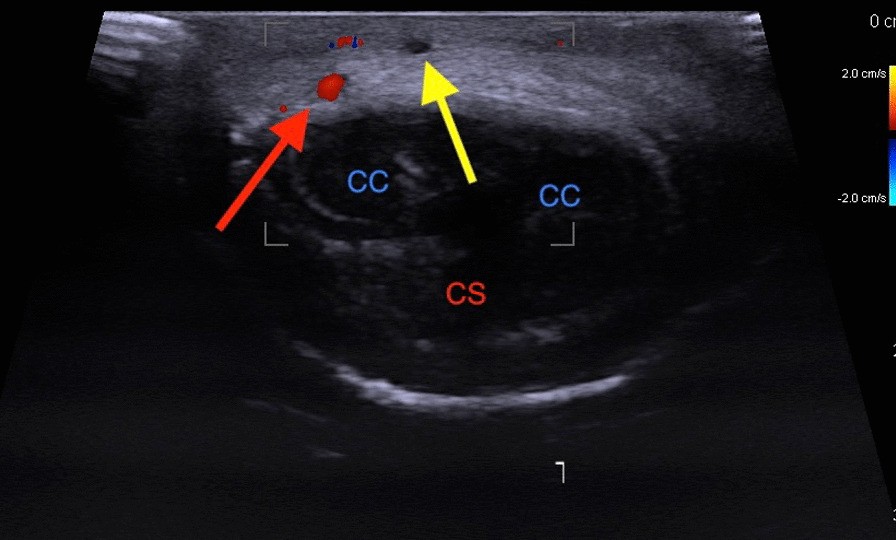 Fig. 2