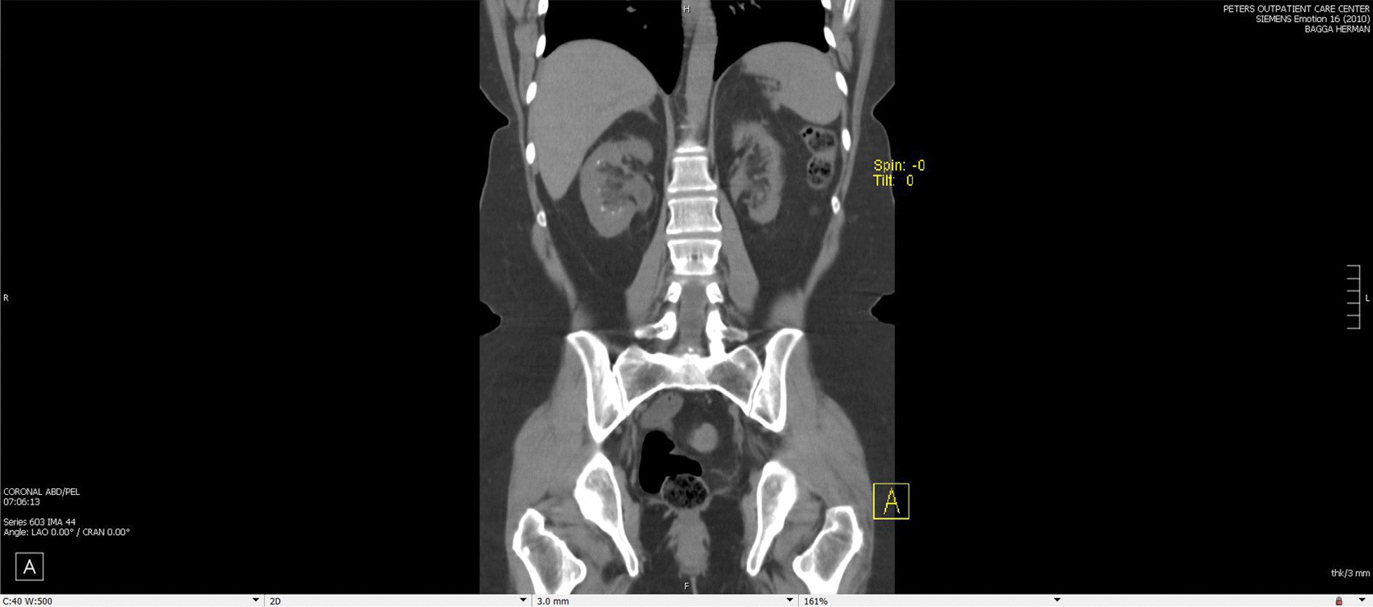 Fig. 2