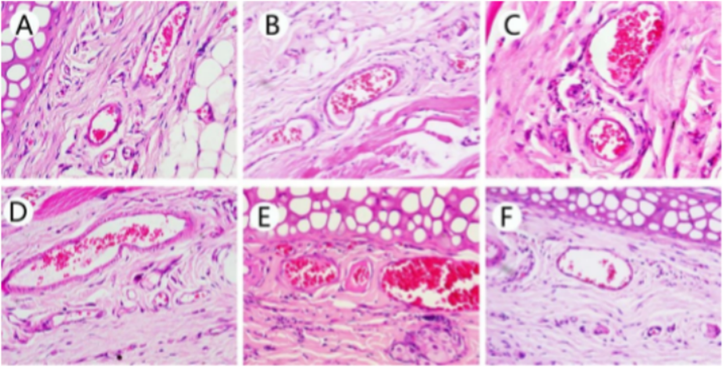 Fig. 12