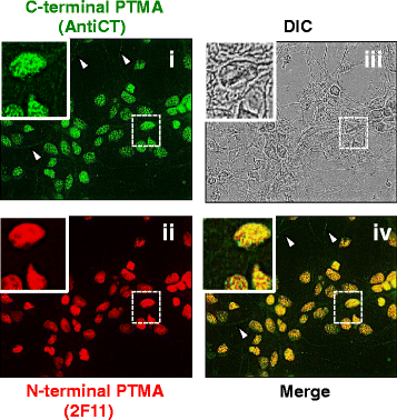 Fig. 12