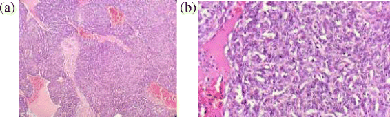 Fig. 13