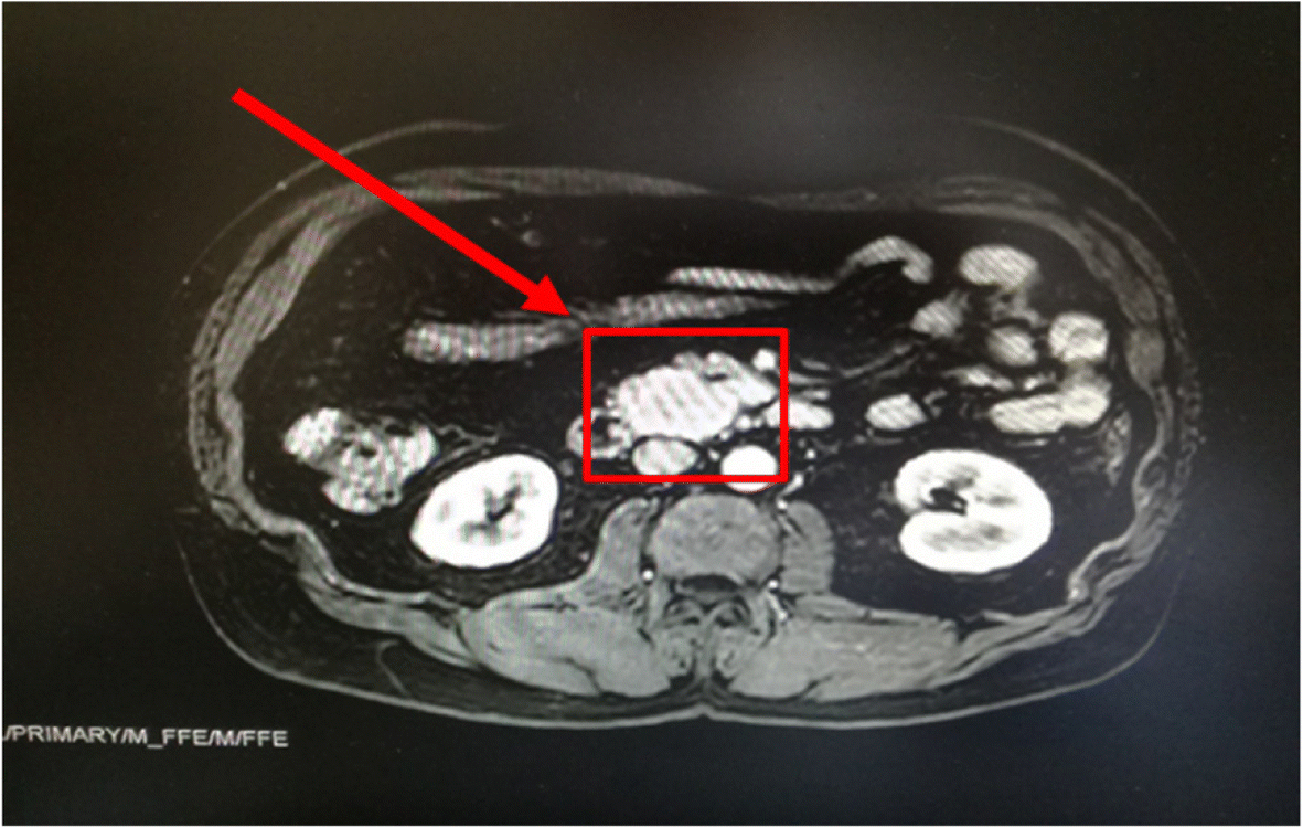 Fig. 1