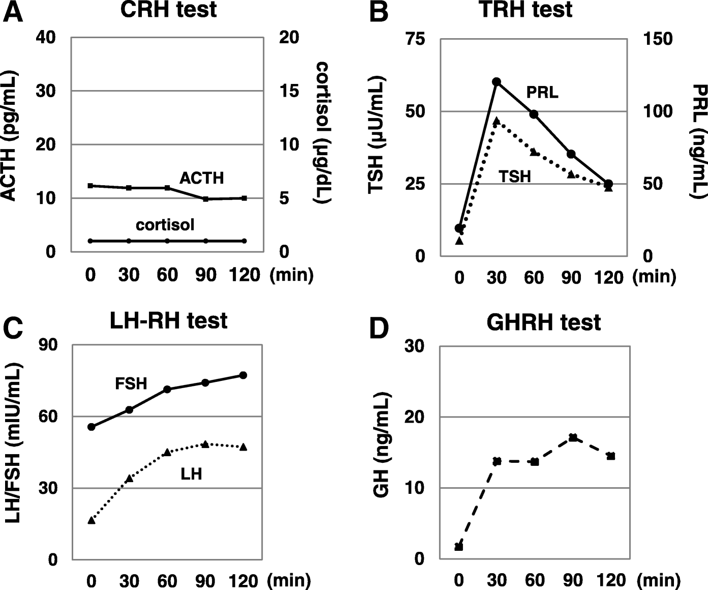 Late Onset Isolated Adrenocorticotropic Hormone Deficiency Caused By Nivolumab A Case Report Bmc Endocrine Disorders Full Text