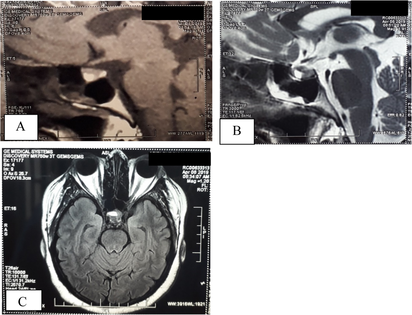 Fig. 2