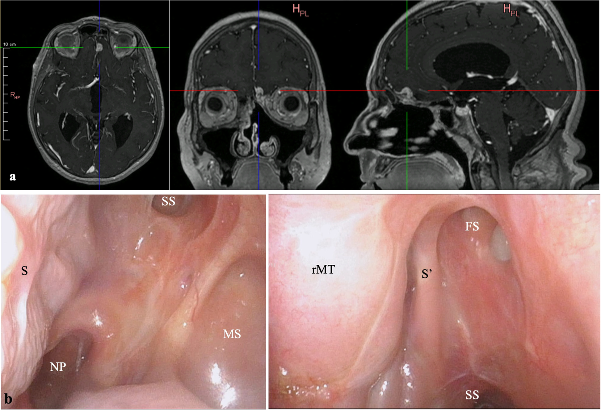 Fig. 8