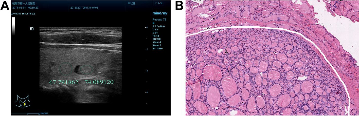 Fig. 3