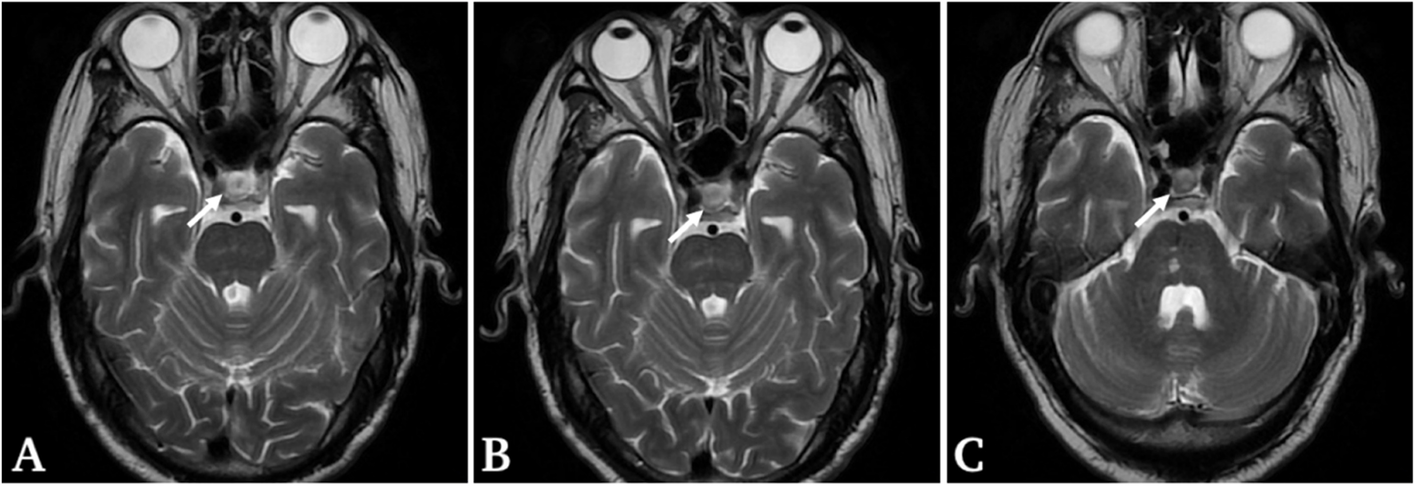 Fig. 2