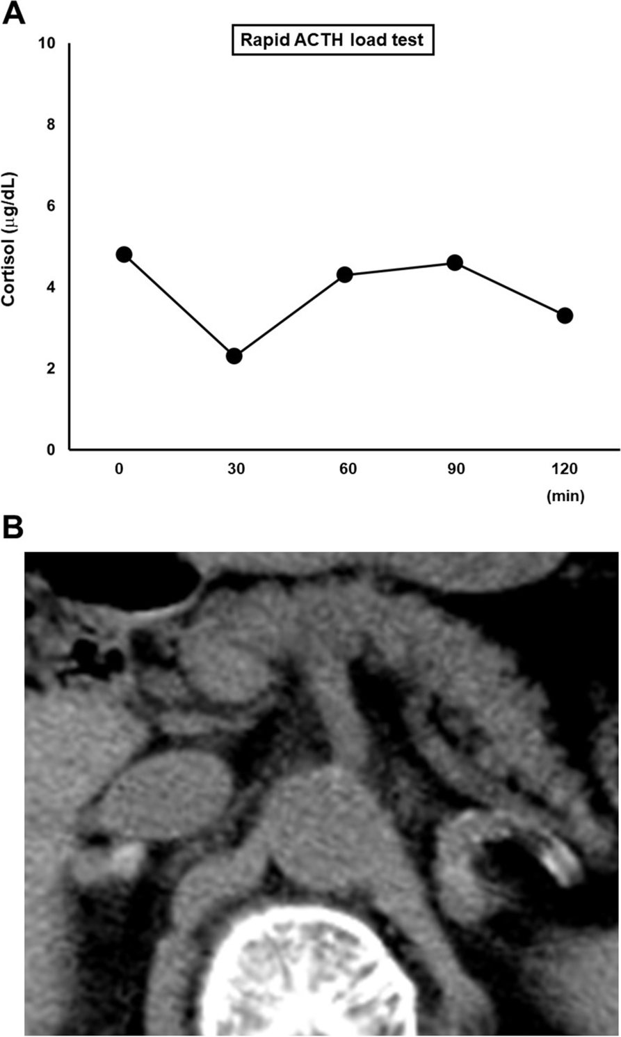 Fig. 2