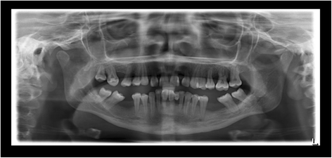 Figure 13