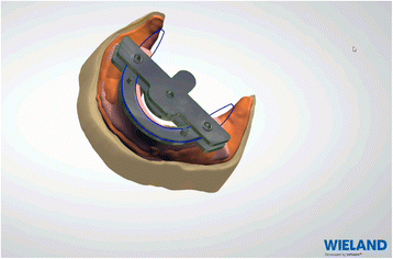 Fig. 10