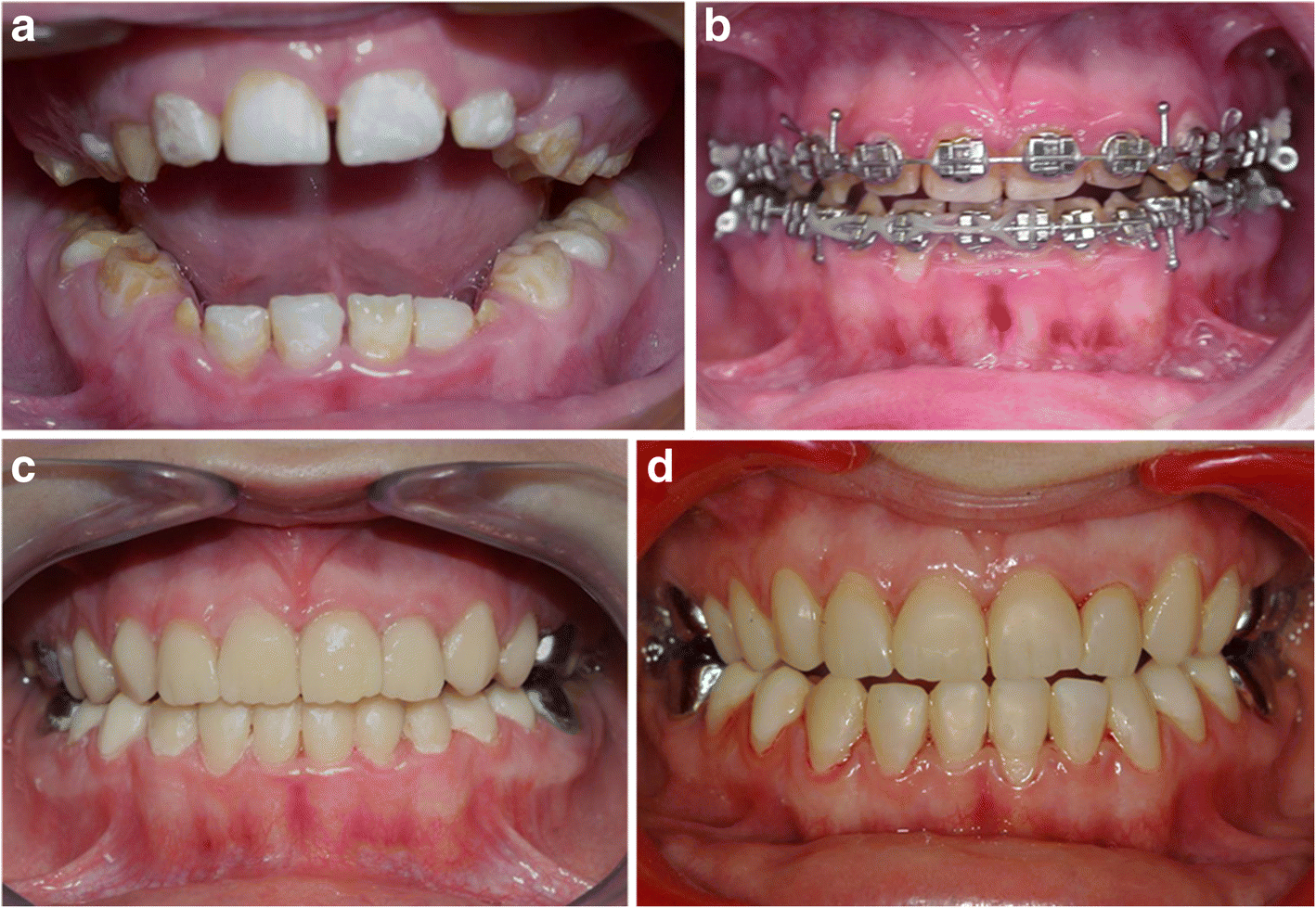 Fig. 3