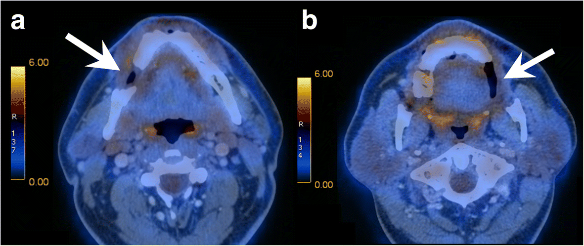 Fig. 9