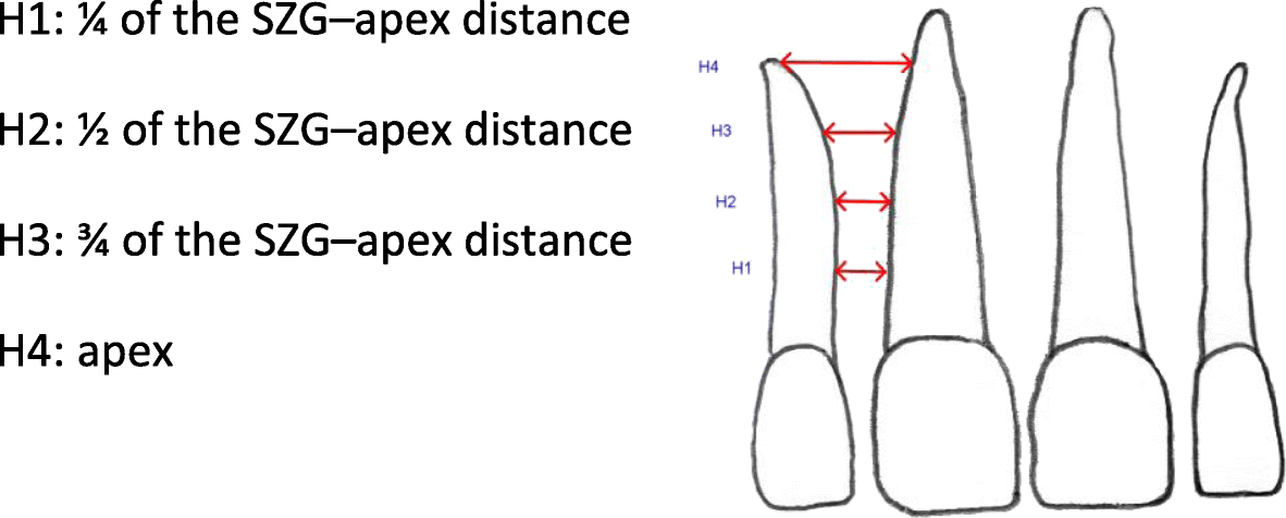 interradicular bone