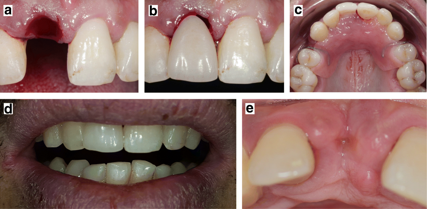 Fig. 4